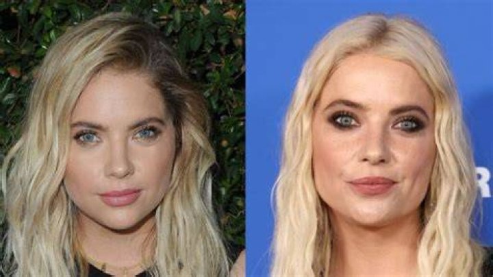 Ashley Benson Plastic Surgery: Did She Go Under the Knife?