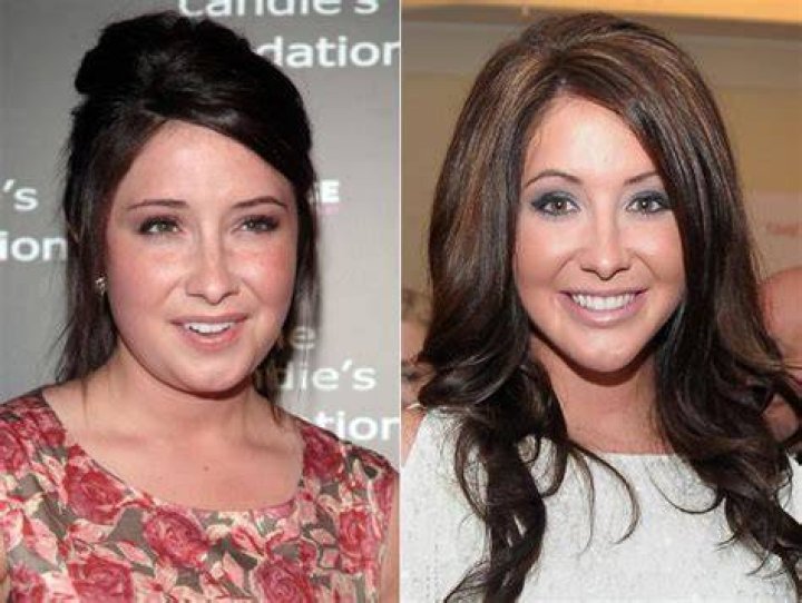 Bristol Palin Plastic Surgery Before and After