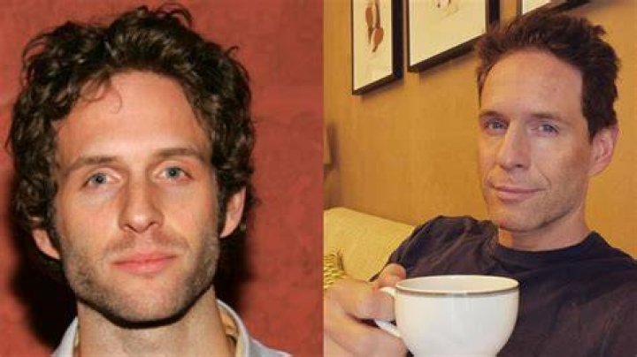 glenn howerton plastic surgery