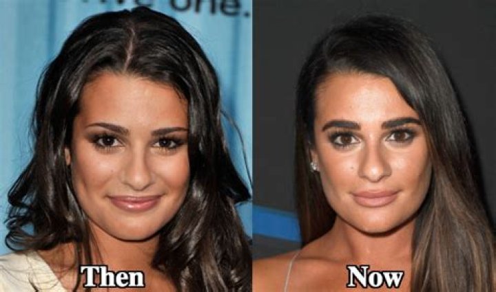 Lea Michele Plastic Surgery Before and After