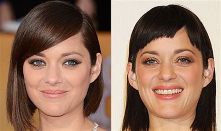 Marion Cotillard Plastic Surgery Before and After